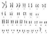horse karyotype