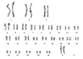 karyotype sheep